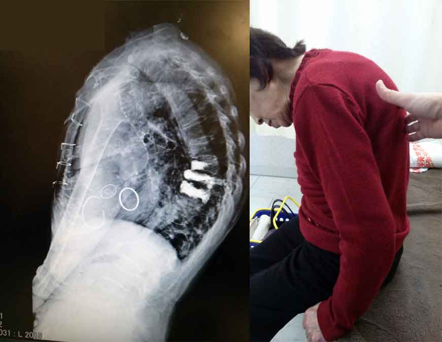 整形外科勤務時に担当していた患者さんの状態