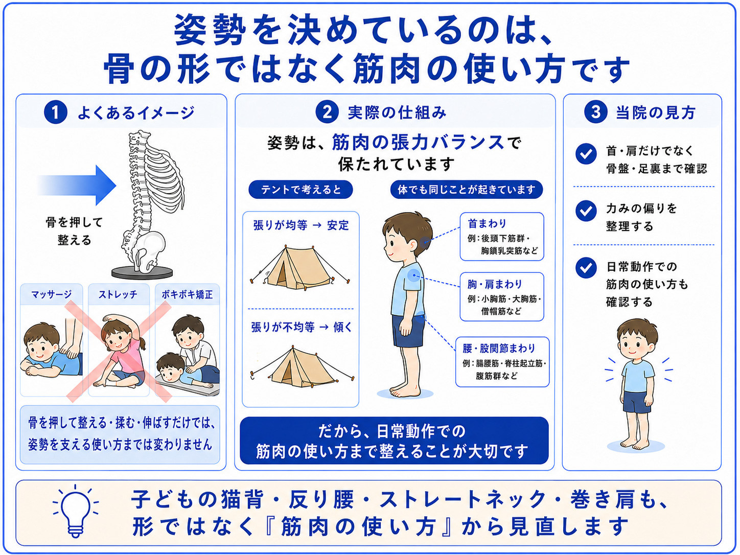 子どもの姿勢は、骨の歪みだけでなく筋肉の使い方や体の支え方が関係することを説明した図
