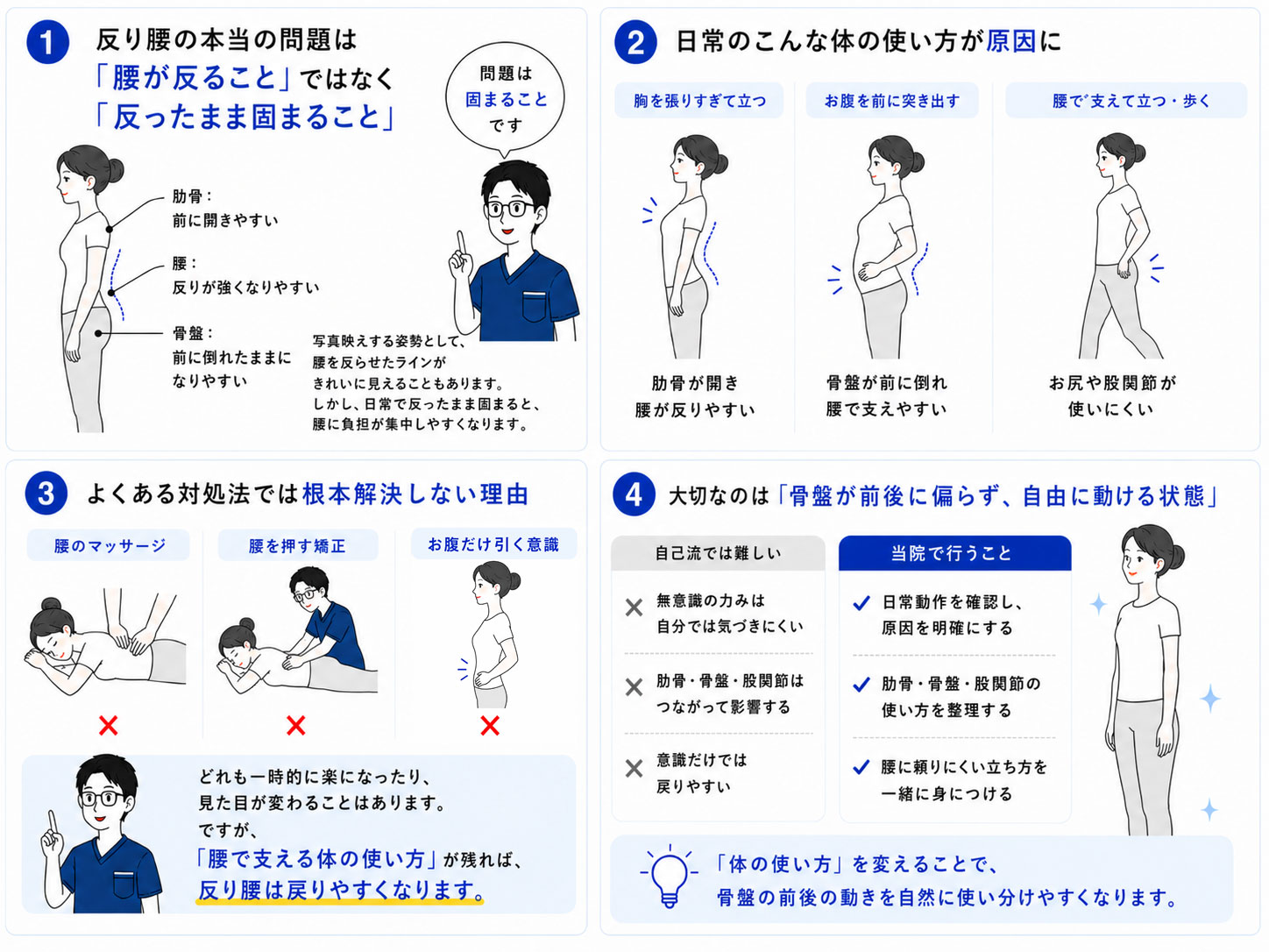 反り腰が戻りやすい理由と改善方向の図解