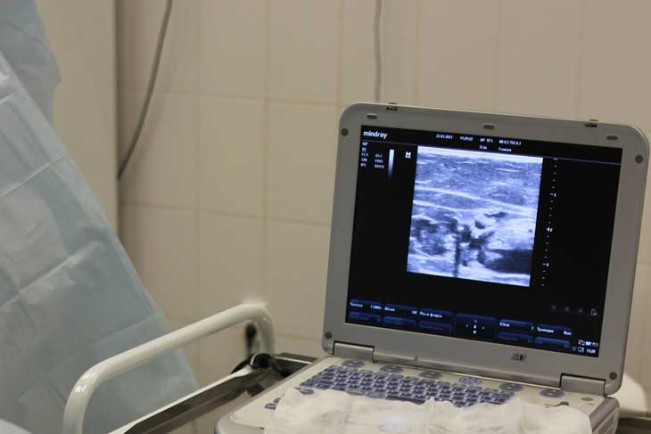 エコー検査のイメージ